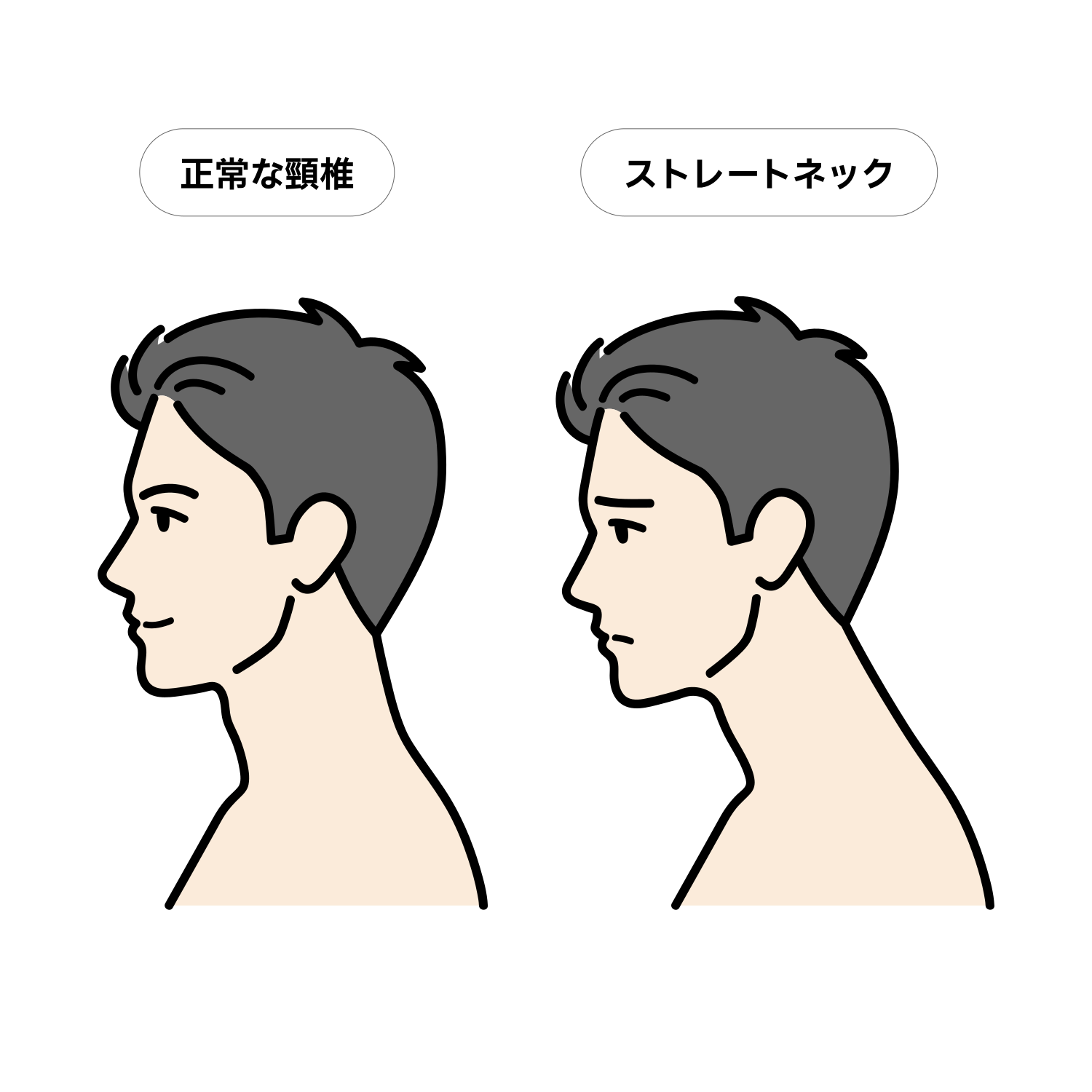 正常な頸椎とストレートネックの比較イラスト（成人男性）
