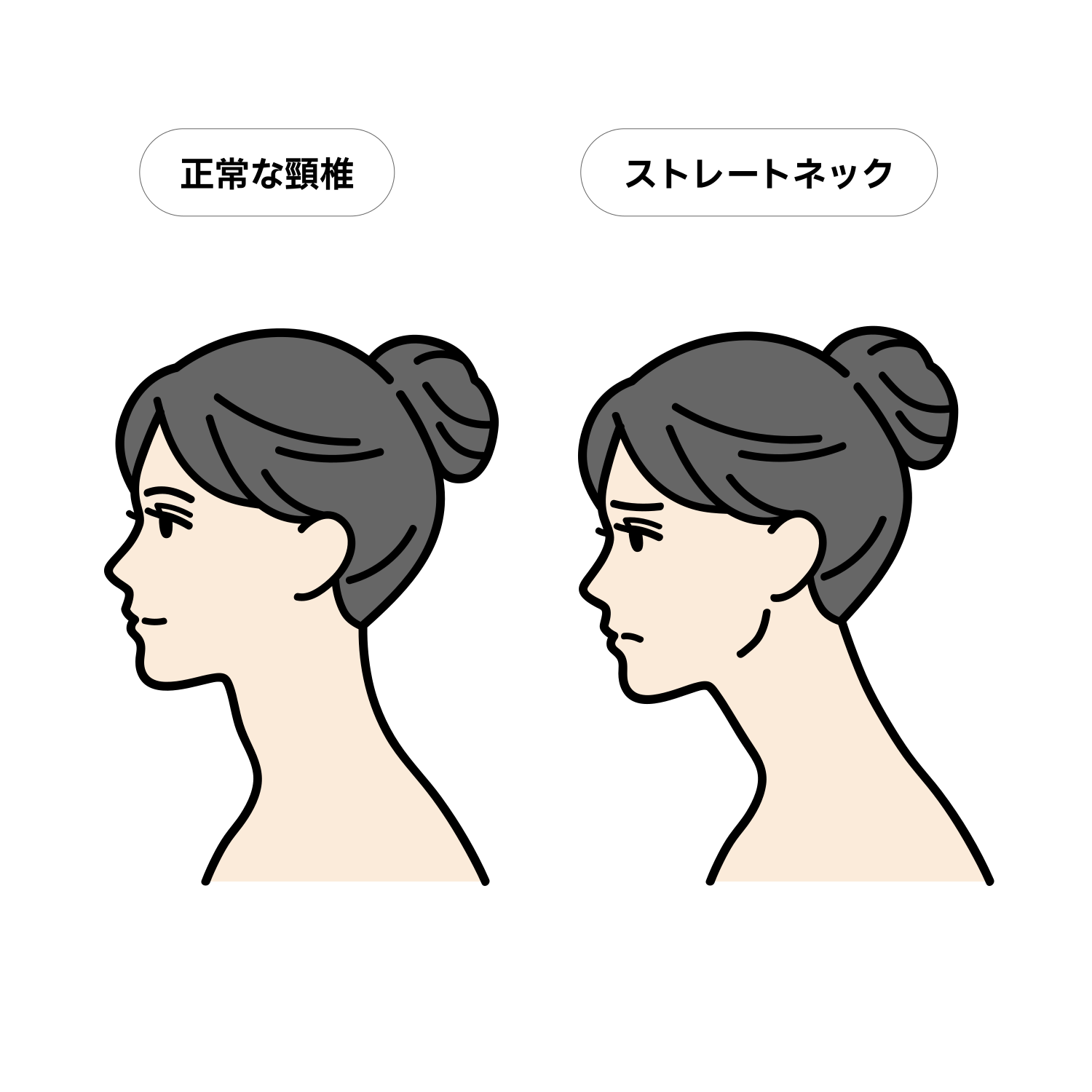正常な頸椎とストレートネックの比較イラスト（成人女性）